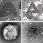 Transmission electron micrographs of Vero cells inoculated with the EDTA blood sample in study of novel Hendra virus variant from horse in Australia. A) Thin section showing inclusion body (IB) within the cytoplasm (C) of multinucleated (N1 and N2) syncytial cell. The nonmembrane bound IB consists of hollow nucleocapsids. B) Thin section showing virion (red arrow) with egress occurring at the plasma membrane. C) Negative contrast analysis shows a double-fringed envelope of the virion (red arrow). D) Negative contrast analysis shows strands of ribonucleic protein characteristic of the family Paramyxoviridae. Scale bars represent 100 nm. 