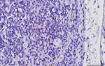 Canine parvovirus type 2 (CPV-2) nucleic acid in a bronchial lymph node obtained from a commercial pig, South Dakota, USA, 2020. Virus was detected by in situ hybridization with a commercially available CPV-2 probe (Advanced Cell Diagnostics, https://acdbio.com). Signals of CPV-2 nucleic acid were hybridized as intracytoplasmic red pinpoints in a few cells morphologically resembling monocyte–macrophage lineage cells in the medullary sinus. Golden-brown pigments are suggestive of hemosiderin accumulated in the cytoplasm of macrophages. The slide was counter-stained with hematoxylin. Scale bar indicates 50 μm.