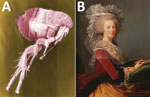 A) Digitally colored scanning electron microscopic image of a flea. Puce is a particularly difficult color to describe. Numerous shades of puce exist, some of which are associated with different anatomic areas of the flea. Image no. 11436: Janice Haney Carr/CDC. B) Portrait of Marie Antoinette painted in 1785 for the Ministry of Foreign Affairs, by Louise Élisabeth Vigée Le Brun. Private collection, Public domain. She seemed to have “preferred a shade leaning more toward ash-gray,” but is seen here modeling a more standard hue of puce.