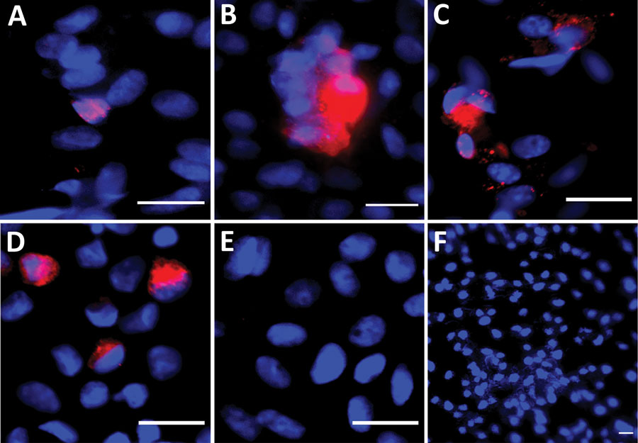 Immunofluorescent images from Vero E6 cells exposed to semen samples obtained at day 7 after symptom onset from volunteers from Réunion Island with dengue virus (DENV) infection in a study of virus clearance and effects on reproductive function. A) Seminal plasma (patient 6); B) whole semen cells (patient 3); C) cells from 40% fraction obtained after semen preparation (patient 6); D) DENV-1 infected Vero E6 cells (positive control) (multiplicity of infection 0.01 for 3 days); E) noninfected Vero E6 cells; F) Vero E6 cells inoculated with noninfected semen (negative controls). VeroE6 cells were inoculated with the semen fractions indicated from DENV-infected (A, B, C) or uninfected patients (E) and cultured for 7 days (first passage). Images were made after detection of DENV envelop protein (DENV-E) from a second passage on VeroE6 of culture supernatants collected after the first passage. Red indicates DENV-E, blue indicates DAPI staining. Scale bars indicate 20 μm. 
