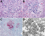 Liver pathology in free-ranging black-tufted marmosets with fatal human alphaherpesvirus 1 infection, Brazil, 2012–2019. A) Intranuclear inclusion bodies in hepatocytes at the margin of a necrotic focus. Hemotoxylin and eosin (H&E) stain; original magnification ×63. B) Multinucleated syncytial cell (arrow). H&E; original magnification ×63. C) Human alphaherpesvirus 1 immunostaining within hepatocytes in an area of necrotizing hepatitis. Immunihistochemistry; original magnification ×40. D) Herpesvirus in the cytoplasm of a hepatocyte. Transmission electron microscopy; scale bar indicates 400 nm.