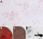 Detection of Haematospirillum jordaniae in a male patient in Slovenia. A) Gram stain of H. jordaniae; original magnification ×1,000. B) Colonies on blood agar after 3-day incubation. C) Colonies on chocolate agar after 3-day incubation. D) Transmission electron micrograph image of negatively stained cell of H. jordaniae exhibiting flagellum. Scale bar indicates 1 μm. 