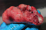 Biopsied lung of a naturally Mycobacterium tuberculosis–infected common long-tailed macaque collected in Thailand. Within the white dashed circle, arrow indicates granuloma and arrowheads indicate multiple-sized granulomas diffused within the lung parenchyma.