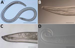 Thelazia callipaeda eyeworms collected from the left eye of a man in Serbia. A) Female worm; B) anterior end of adult female; C) posterior end of adult female; D) posterior end of adult male.