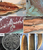 Anisakid larvae found in frozen (A–C, E–H) and ready-to-eat (D) Atlantic herrings (Clupea harengus), Slovakia. A) Cluster of larvae on the viscera (arrowhead). B) Larva in dorsal muscle (arrowhead). C) Larva partly embedded in the hard roe. D) Larva on the surface of the soft roe (arrowhead). E) All larvae isolated from single fish. Original magnification as indicated. F–H) Light microscope photographs of head part (F), ventriculus (G), and tail part (H) of an Anisakis simplex sensu stricto nematode. Scale bars indicate 200 µm.