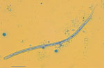 Microscopic image of Dirofilaria repens microfilaria in case study of microfilaremic D. repens infection in patient from Serbia. A blood sample from the patient was processed and stained with methylene blue. Scale bar indicates 200 μm.