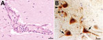 Results of testing for highly pathogenic avian influenza virus in red foxes (Vulpes vulpes), Germany. A) Microscopic findings in the brain of an influenza A(H5N1) virus‒infected red fox showing a lymphocytic to histiocytic perivascular encephalitis (hematoxylin and eosin stained, scale bar = 50 μm). B) Immunohistochemical demonstration of influenza A virus nucleoprotein in neurons (arrows) and glial cells (arrowheads) in the cerebrum of a virus‒infected red fox (avidin biotin complex method, scale bar = 20 μm).