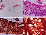 Microscopic findings in ileocolonic biopsy specimens (second colonoscopy) in a man in Japan who had recurrent Helicobacter fennelliae bacteremia. A) Morphologic features of the bacteria in a cecal tissue suspension with Gram staining (original magnification ×2,000). Arrow indicates gram-negative spiral bacilli. B) Histologic findings in a biopsy specimen taken from the transverse colon with hematoxylin-eosin staining (original magnification ×200). The colonic mucosa shows mild leukocytic infiltration. C) Histologic findings in a biopsy specimen taken from the transverse colon with Warthin-Starry silver staining (original magnification ×200). Bacteria are aggregated in crypts (arrowheads) D) Morphologic features of bacteria obtained from the transverse colon with Warthin-Starry silver staining (original magnification ×1,000). A cluster of spiral bacilli was observed.