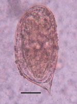 Schistosoma incognitum egg identified in the feces of a woman from Tamil Nadu, India. Saline direct smear. Original magnification ×400; scale bar indicates 25 µm. 