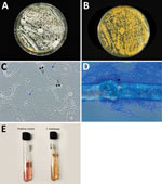 Results of gross and microscopic morphology and microbiological laboratory testing to identify Trichophyton indotineae in a woman in Pennsylvania, USA. A, B) Colonies were velvety white, flat, and had a raised center (arrow) (A) and a light yellow pigment on reverse (B). C) Numerous microconidia showed the pyriform and clavate forms (black arrow) and fungal hyphae with septation (blue arrows). Original magnification ×40. D) In vitro hair perforation test was positive (arrow). Original magnification ×100. E) T. indotineae had a negative urease test (yellowish color), while the positive control, Trichophyton tonsurans, was pinkish. 