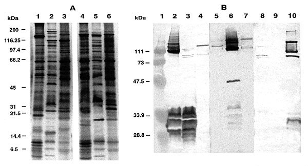(A) Silver-stained SDS-PAGE of whole-cell protein preparations of Rickettsia conorii, the ELB agent and R. typhi. Lane 1, R. conorii; lane 2. ELB agent; lane 3, R. typhi; lane 4, heated R. conorii; lane 5, heated ELB agent; lane 6, heated R. typhi. Molecular weights are indicated on the left. (B) Western blot of rickettsial proteins probed with various antisera. R. conorii antigens (lanes 2, 6, and 10), ELB agent antigens (lanes 3, 7, and 11) and R. typhi antigens (lanes 4, 8, and 12) were probe