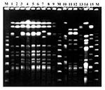 Thumbnail of Pulsed-field gel electrophoresis pattern of XbaI-digested genomic DNA of Stenotrophomonas maltophilia isolates from two SM-RE patients. Lanes 1-10 from patient 1 (persistence group): pattern 1a (lanes 1,3-6,8), pattern 1b (ln 7), pattern 1c (lane 9) and pattern 2 (lane 2); lanes 10-15 from patient 5 (variability group): pattern 3 (lane 10), pattern 4 (lane 11,12), pattern 5 (lane 13), pattern 6 (lane 14), pattern 7 (lane 15). Lanes M, bacteriophage lambda standard marker.