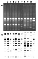 Thumbnail of A) RAPD patterns of Corynebacterium diphtheriae isolated from 1995 to 1997. Lane 1, 1740 (strain #), gravis, G1/4 RAPD type strain. Lane 2, B327, gravis, G1/4 (RAPD type), 1997 (year of isolation). Lane 3, B400, mitis, G1/4, 1995. Lane 4, 490, gravis, G1/4 ribotyping type strain. Lane 5, B375, gravis, G1/4, 1995. Lane 6, B294, mitis, G1/4, 1996. Lane 7, B325, gravis, G4v, 1997. Lane 8, 860, mitis, M1/M1v RAPD type strain. Lane 9, B389, mitis, M1/M1v, 1995. Lane 10, B324, mitis, M1/M