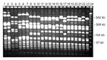 Thumbnail of Pulsed-field gel electrophoresis (PFGE) profiles of Staphylococcus aureus isolates digested with Sma 1. A variety of PFGE profiles are demonstrated in these 23 isolates.