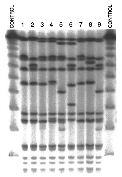 SmaI-pulsed-field gel electrophoresis of nine Staphylococcus aureus strains representative of the most prevalent MRSA clonal type in North America.