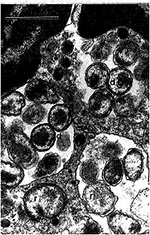 Thumbnail of Human granulocytic ehrlichiae (BDS strain) in an equine peripheral blood nneutrophil are located within four morulae. Reticulate (r) and dense-cored (d) cells are surrounded by two membranes: cell wall membrane and cytoplasmic membrane. Bar = 1 µm; magnification, x 27,000. (Courtesy of Vsevolod Popov, University of Texas Medical Branch at Galveston.)