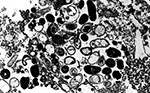 Thumbnail of Transmission electron micrograph of a host cell from cell culture parasitized by Encephalitozoon intestinalis. Both vegetative forms and spores can be observed inside the parasitophorous vacuole. Original magnification, x5,200.