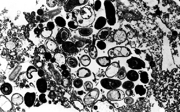 Transmission electron micrograph of a host cell from cell culture parasitized by Encephalitozoon intestinalis. Both vegetative forms and spores can be observed inside the parasitophorous vacuole. Original magnification, x5,200.