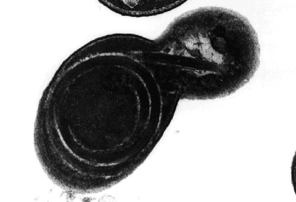 Transmission electron micrograph of a cell culture-derived Encephalitozoon intestinalis spore showing the polar tubule in the process of being extruded. The coiled arrangement of the tubule within the spore is clearly demonstrated. Original magnification, x39,000.