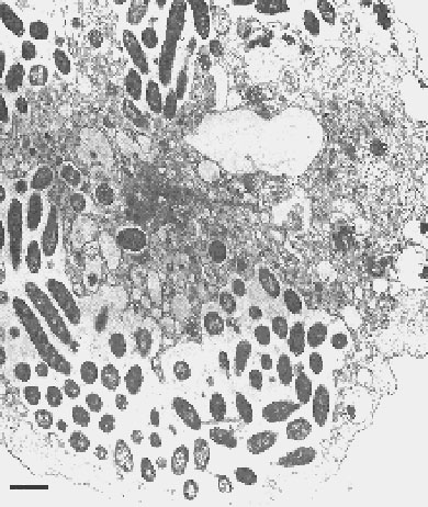 Transmission electron micrograph of Sarcobium lyticum within Acanthamoeba castellanii. Bar = 1 µm. (Reproduced with permission from reference 7.)