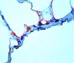 Thumbnail of Ebola virus antigen-positive cells (red) in lung of an insectivorous bat as determined by immunohistochemistry. Note prominent endothelial immunostaining. (Rabbit anti-Ebola virus serum, napthol/fast red with hematoxylin counterstain, original magnification x 250).