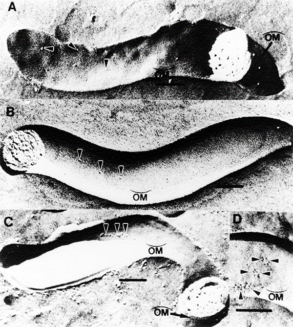 Freeze-fracture electron microscopy of T. pallidum subsp. pallidum demonstrating TROMP aggregation. Concave  and convex   outer membrane fracture faces (OM). T. pallidum incubated in heat-inactivated normal rabbit serum for 16 hours (A), in immune rabbit serum for 2 hours (B), and in immune rabbit serum for 16 hours (C) and (D). Arrows show individual (A&amp;B) and aggregated (C&amp;D) TROMPs. Bar in each micrograph represents 0.1mm. Photograph reprinted with the permission of the Journal of I