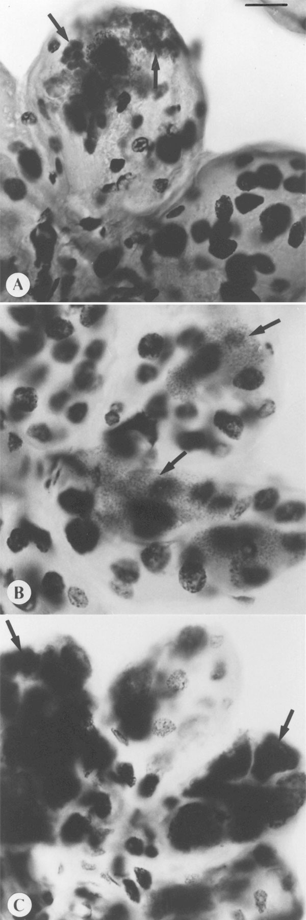 Comparison of morphology and tinctorial properties of Feulgen stained, intact tick salivary glands infected by three of the deer tick pathogen guild. Spirochetes only transiently migrate through salivary tissues, and thus would not be visualized by this technique. (A) Ehrlichia microti. Polyhedral clusters of rickettsiae (arrows) within hypertrophied salivary acinus. (B) Babesia microti, dense stippling of sporoblasts (arrows). Each minute dot represents the nucleus of a sporozoite. (C) Deer tic