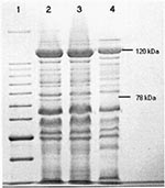 Thumbnail of Coomassie blue stained polypeptide profiles of the R. felis, R. typhi, and R. akari plaque-purified seeds separated by SDS-PAGE (7.5%). Lane 1: 10kDa molecular mass marker, with 78 and 120kDa sizes indicated; Lane 2: R. felis; Lane 3: R. typhi (Wilmington); and Lane 4: R. akari (Kaplan).