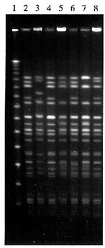 Thumbnail of Pulsed-field gel electrophoresis of XbaI-digested genomic DNA of O157 VTEC PT2 isolated from outbreaks in 1995. Digests were separated on 1% agarose for 42h at a voltage gradient of 5.6 volts per cm with a pulse ramp time of 5 to 50 sec. Lane 1 contained a phage lambda DNA 48.5 kb ladder (Sigma). Lanes 2 to 8 contained digests of PT2 strains from outbreaks as follows: lane2, outbreak 1; lane3, outbreak 2; lane4, outbreak 4; lane5, outbreak 5; lane6, outbreak 6; lane7, outbreak 8; la