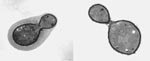 Thumbnail of Transmission electron micrograph C. neoformans showing the characteristic polysaccharide capsule.