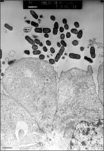 Thumbnail of Effects of enteroaggregative E. coli strain 042 on T84 cells in culture. Polarized T84 monolayers were washed and inoculated with 106 CFU of 042 and allowed to coincubate at 37°C for 6 hrs. Transmission electron microscopy reveals adherence of bacteria to the apical surface of the T84 cells without internalization. The apical brush border is effaced; cells are ballooning and will eventually be extruded from the monolayer. (J.P. Nataro and S. Sears, unpub. data). Bar, 1 mm.
