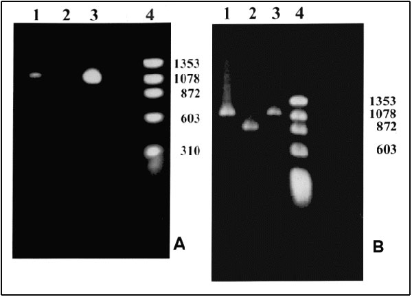 Polymerase chain reaction (PCR) products. A. With primers for the NadA gene. Lane 1: Patient's sample with an approximately 1.02-kb product; Lane 2: Negative control; Lane 3: Positive control. Ehrlichia chaffeensis (Arkansas strain)–infected DH82 cells; Lane 4: Molecular size markers: fX174 phage DNA cleaved with HaeIII. B. With nested primers for the 120 kDa protein gene. Lane 1: Patient's sample with an approximately 1.1-kb product; Lane 2: Positive control. E. chaffeensis (Sapulpa strain)–DH8