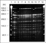 Thumbnail of Pulsed-field gel electrophoresis profiles of Xba I-digested genomic DNA from drug-resistant and drug-sensitive isolates of Salmonella Typhi Vi-phage types E1, M1, and UVS. Tracks 1-20 contained 1 and 20, lambda 48.5-kb ladder (Sigma); 2, M1 type strain (S. Typhi PFP Stp X7); 3, P3044890 (PFP X8a); 4, P3112100 (PFP X8); 5, E1 type strain (PFP X1); 6, P3640980 (PFP X2a); 7, P3639160 (PFP X2a); 8, P2967750 (PFP X2a); 9, P4405140 (PFP X2a); 10, P4405200 (PFP X2a); 11, P4632360 (PFP X2a)