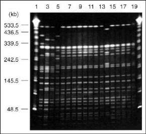 Pulsed-field gel electrophoresis profiles of Xba I-digested genomic DNA from drug-resistant and drug-sensitive isolates of Salmonella Typhi Vi-phage types E1, M1, and UVS. Tracks 1-20 contained 1 and 20, lambda 48.5-kb ladder (Sigma); 2, M1 type strain (S. Typhi PFP Stp X7); 3, P3044890 (PFP X8a); 4, P3112100 (PFP X8); 5, E1 type strain (PFP X1); 6, P3640980 (PFP X2a); 7, P3639160 (PFP X2a); 8, P2967750 (PFP X2a); 9, P4405140 (PFP X2a); 10, P4405200 (PFP X2a); 11, P4632360 (PFP X2a); 12, P466397