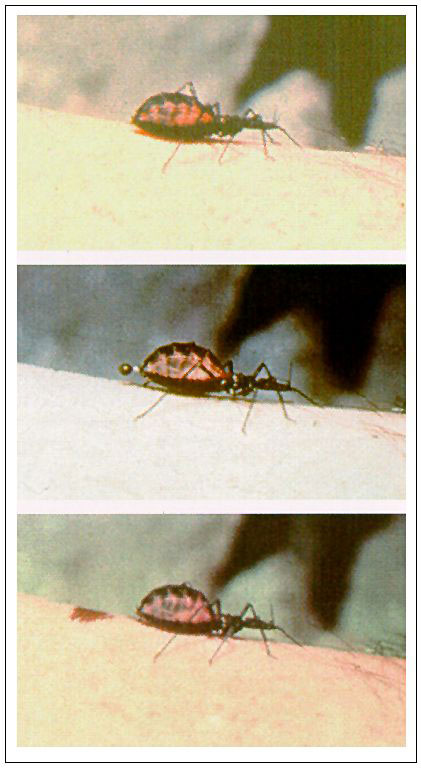 A triatomine bug vector of Chagas disease in the process of feeding. The fecal droplet contains infective trypanosomes and bacterial symbionts. (Photographs courtesy of Robert B. Tesh).