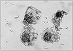 Thumbnail of The tsetse secondary symbiont GP01 growing intracellularly and extracellularly in culture.