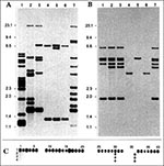 Thumbnail of IS6110 (a) and IS1081 (b) hybridization patterns of PvuII-digested genomic DNA. Lanes 1 to 3: clinical M. tuberculosis isolates; lane 4: the Somali isolate, So93; lane 5: the Canetti strain isolated in France in 1969; lane 6: the Swiss isolate, NZM 217/94; lane 7: M. tuberculosis Mt14323 (reference strain). Figure c represents spoligotyping patterns. Lane 1: M. tuberculosis H37Rv (reference strain); lane 2: the Canetti strain; lane 3: the Somali isolate, So93; lane 4: the Swiss isol