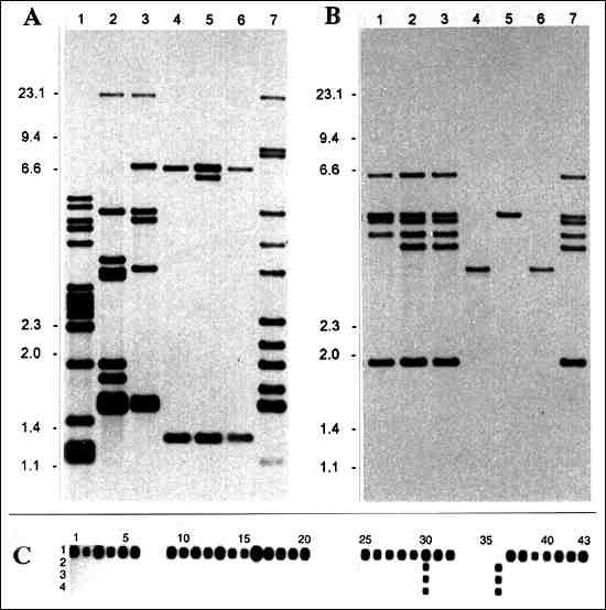 IS6110 (a) and IS1081 (b) hybridization patterns of PvuII-digested genomic DNA. Lanes 1 to 3: clinical M. tuberculosis isolates; lane 4: the Somali isolate, So93; lane 5: the Canetti strain isolated in France in 1969; lane 6: the Swiss isolate, NZM 217/94; lane 7: M. tuberculosis Mt14323 (reference strain). Figure c represents spoligotyping patterns. Lane 1: M. tuberculosis H37Rv (reference strain); lane 2: the Canetti strain; lane 3: the Somali isolate, So93; lane 4: the Swiss isolate, NZM 217/