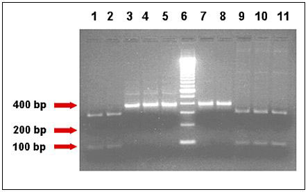 Human- and bovine-specific restriction enzymes showed distinct banding pattern for genotypes of Cryptosporidium parvum isolates. The different lanes represent the TRAP-C2 PCR-amplified products belonging to AGA43, AMD36, AOH6, HM3, and HM5 isolates of C. parvum, respectively, after digestion with HaeIII (Lanes 1-5, human-specific marker) and BstE II (Lanes 7-11, bovine-specific marker) restriction enzymes and agarose gel electrophoresis. Lane 6 is the 100 bp marker. Samples AGA43, AMD36 and AOH6