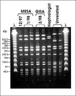 Thumbnail of Pulsed-field gel electrophoresis (PFGE) profiles of SmaI digested DNA. Case patient MRSA isolates from December 1997 and January 1998, GISA isolate from March 1998. Nephrologist MRSA isolate from March 1998 and unrelated MRSA isolates.