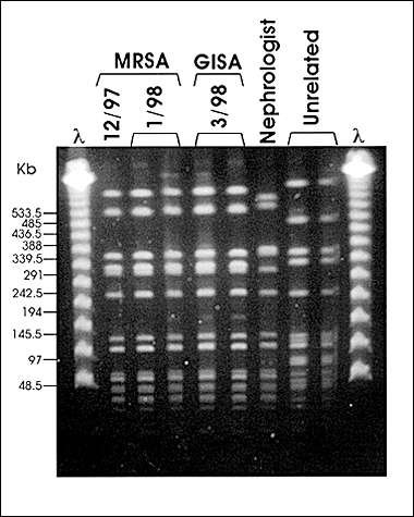 Pulsed-field gel electrophoresis (PFGE) profiles of SmaI digested DNA. Case patient MRSA isolates from December 1997 and January 1998, GISA isolate from March 1998. Nephrologist MRSA isolate from March 1998 and unrelated MRSA isolates.