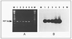 Thumbnail of Polymerase chain reaction (PCR) detection of Mycoplasma penetrans in clinical samples. A. M. penetrans PCR genomic amplification with the primers MYCPENET-P and MYCPENET-N (7) and analyzed by electrophoresis in 2% agarose gel. Lysates from the following original samples: throat swab (lane 1); tracheal aspirate (lane 2); blood (lane 3); first blood subculture (HF-1 isolate) (lane 4); M. penetrans GTU-54-6A1 (lane 5), showing the amplification product of 407-bp; and negative control (