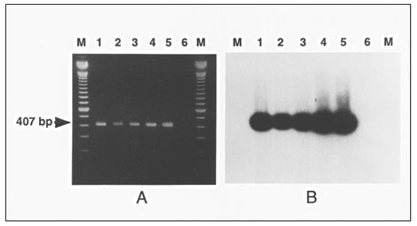 Polymerase chain reaction (PCR) detection of Mycoplasma penetrans in clinical samples. A. M. penetrans PCR genomic amplification with the primers MYCPENET-P and MYCPENET-N (7) and analyzed by electrophoresis in 2% agarose gel. Lysates from the following original samples: throat swab (lane 1); tracheal aspirate (lane 2); blood (lane 3); first blood subculture (HF-1 isolate) (lane 4); M. penetrans GTU-54-6A1 (lane 5), showing the amplification product of 407-bp; and negative control (lane 6). B. S