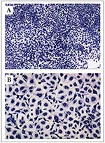 Thumbnail of The effect of cytotoxic necrotizing factor type 1 (CNF1) on eukaryotic cells. A. HEp-2 cells, magnification 10X. B. HEp-2 cells intoxicated with CNF1, magnification 10X.