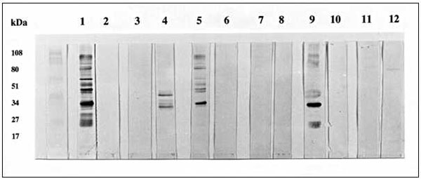 Western blot of Toxoplasma gondii or Neospora caninum antigen. Analysis was performed essentially as described by Sharma et al. (12) by using tachyzoites from in vitro culture of the N. caninum NC-1 isolate (13) and the T. gondii RH strain (10). Lanes 1-4 were probed with control sera and lanes 5-12 with human sera with high absorbencies in the N. caninum enzyme-linked immunosorbent assay.  Lane 1: T. gondii-positive human serum and T. gondii antigen; Lane 2: N. caninum-positive pig serum and T.