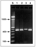 Thumbnail of Agarose gel (2%) visualization of diagnostic polymerase chain reaction products of four Cryptosporidium genotypes. Lane S, standard 100-bp ladder; lane 1, patient 53, zoonotic genotype 2; lane 2, patient 119, Cryptosporidium sp. (zoonotic, canine genotype); lane 3, patient 84, C. felis (zoonotic, feline genotype); lane 4, patient 75, anthroponotic genotype 1.