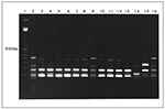 Thumbnail of Fingerprint patterns obtained for Staphylococcus aureus small colony variants (lanes 3-5, bloodculture isolates; lanes 6 and 7, isolates from hip abscess; lane 8, postmortem specimen) and S. aureus isolates with a normal phenotype (lanes 10 and 11, isolates from nose and throat; lanes 12 and 13, isolates from hip abscess and postmortem specimen) after polymerase chain reaction (PCR) analysis of inter-IS256 spacer length showing identical strains. Lane 1, 100-bp ladder; lanes 2, 9, a