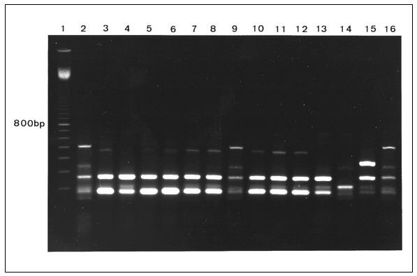 Fingerprint patterns obtained for Staphylococcus aureus small colony variants (lanes 3-5, bloodculture isolates; lanes 6 and 7, isolates from hip abscess; lane 8, postmortem specimen) and S. aureus isolates with a normal phenotype (lanes 10 and 11, isolates from nose and throat; lanes 12 and 13, isolates from hip abscess and postmortem specimen) after polymerase chain reaction (PCR) analysis of inter-IS256 spacer length showing identical strains. Lane 1, 100-bp ladder; lanes 2, 9, and 16, methic