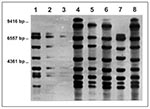 Thumbnail of Ribosomal RNA gene restriction patterns obtained by using restriction enzyme Pvu II of Corynebacterium diphtheriae isolates belonging to ribotypes B (lanes 1 to 3), A (lanes 4 to 6 and 8), and C (lane 7).
