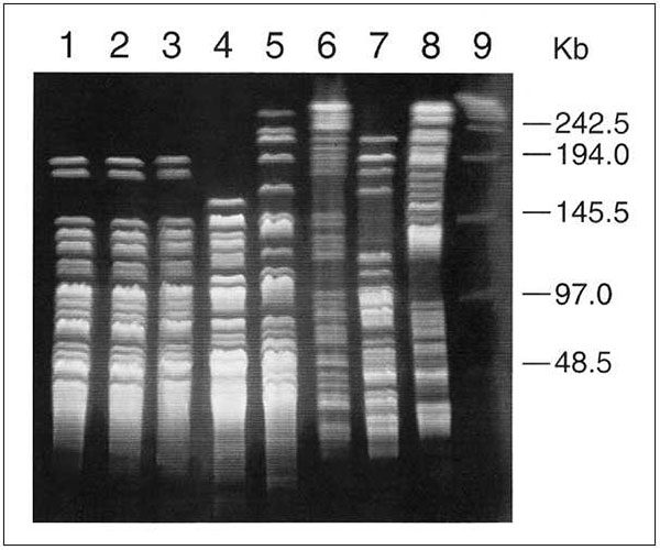 Pulsed-field gel electrophoresis patterns of three Mycobacterium abscessus isolates from the outbreak (lanes 1-3), five control isolates (lanes 4-8), and lambda DNA standards (lane 9). The chromosomal DNA was digested with XbaI.